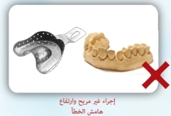 Dental implants in Türkiye (esthetica Hospital in Istanbul)